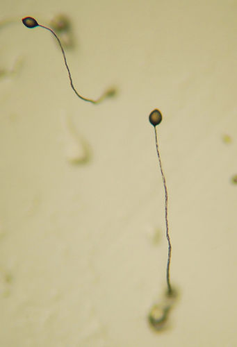 Dictyostelium discoideum